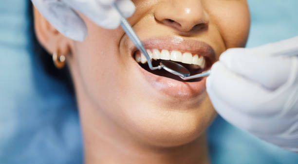 Best Emergency Tooth Extraction in Shoemakersville, PA