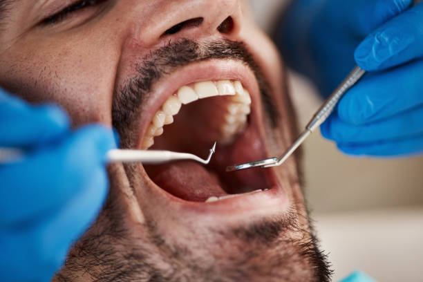 Best Emergency Treatment for Toothache in Shoemakersville, PA